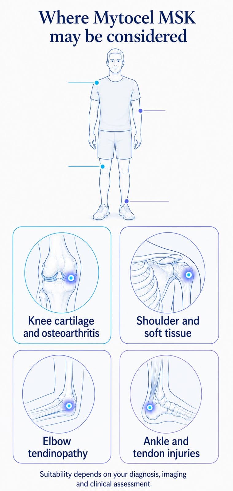 Where Mytocel MSK may be considered: knee cartilage and osteoarthritis, shoulder and soft tissue, elbow tendinopathy, and ankle and tendon injuries. Suitability depends on diagnosis, imaging and clinical assessment.