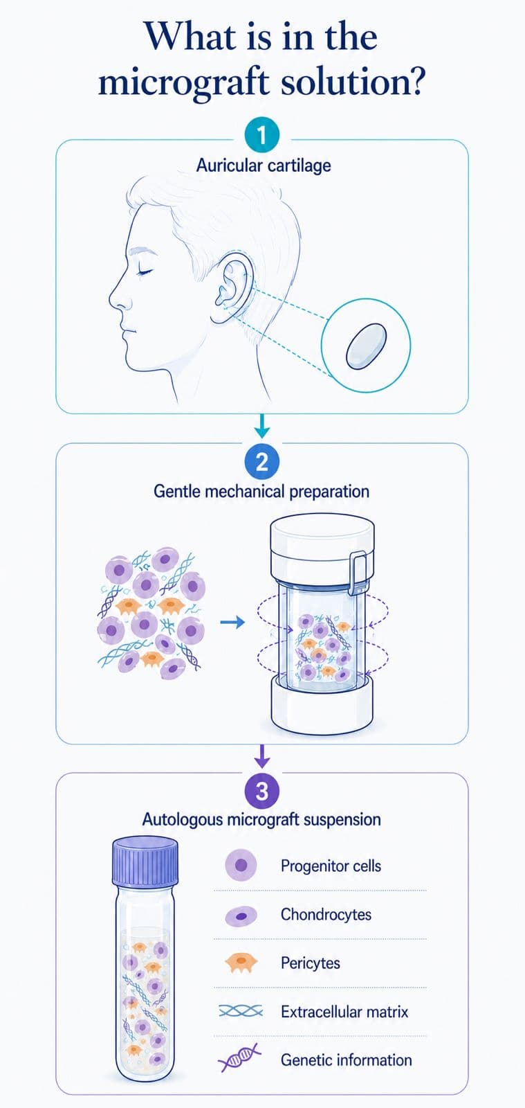 What is in the micrograft solution: auricular cartilage is sampled, gently prepared by mechanical disaggregation, and collected as an autologous micrograft suspension containing progenitor cells, chondrocytes, pericytes, extracellular matrix and genetic information.