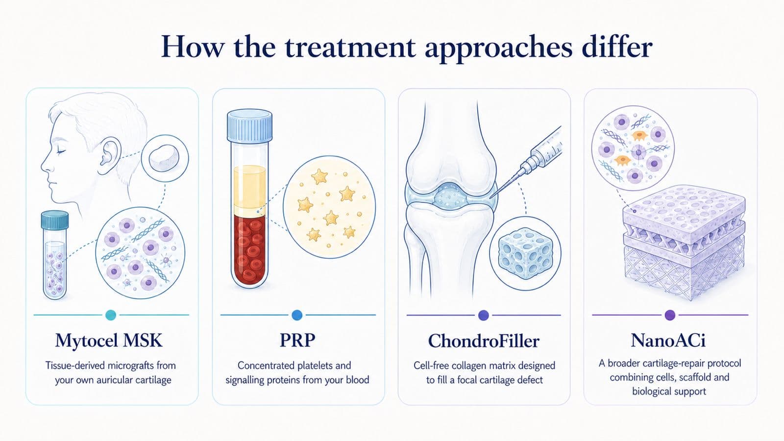 How the treatment approaches differ: Mytocel MSK uses tissue-derived micrografts from the patient's own auricular cartilage; PRP uses concentrated platelets and signalling proteins from blood; ChondroFiller is a cell-free collagen matrix for a focal defect; NanoACi combines cells, scaffold and biological support.