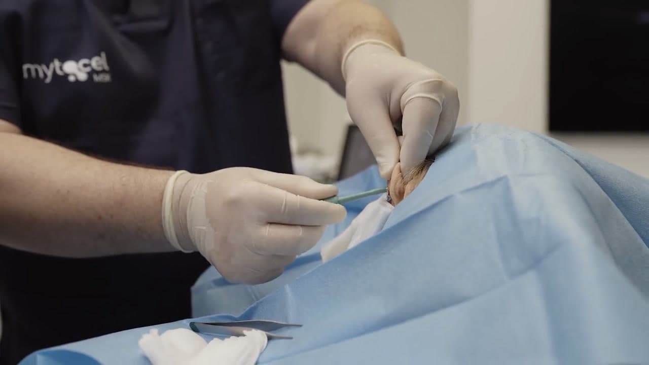 A clinician in Mytocel MSK scrubs taking the auricular sample during a supervised case