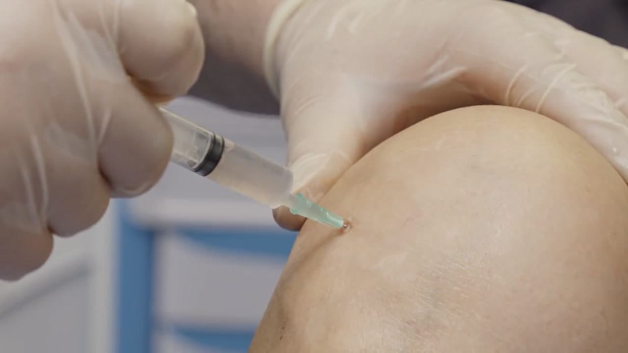 A clinician injecting the prepared suspension into a patient’s knee