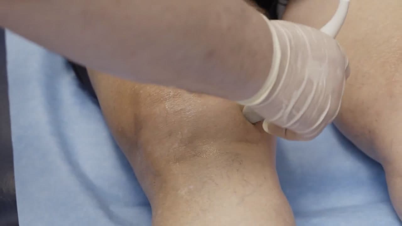 A clinician holding an ultrasound probe on a patient’s knee